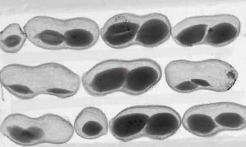 In a first, ICRISAT employs X-ray tech to assess quality of peanuts